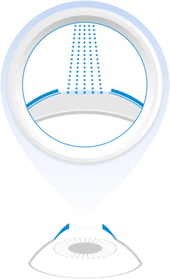 How Laser Eye Surgery Works in Atlanta