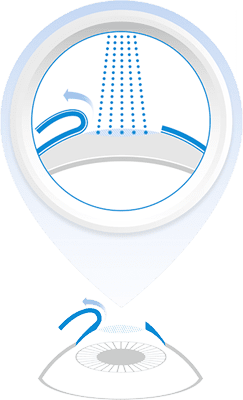 How Laser Eye Surgery Works in Atlanta