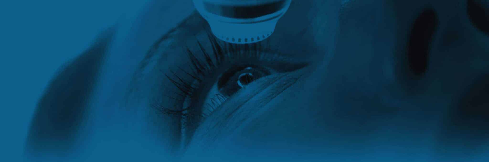 SMILE Laser Eye Surgery in Atlanta